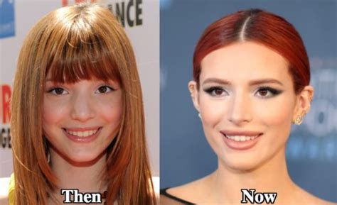 does bella thorne have fake boobs|Bella Thorne Plastic Surgery Before and After Photos